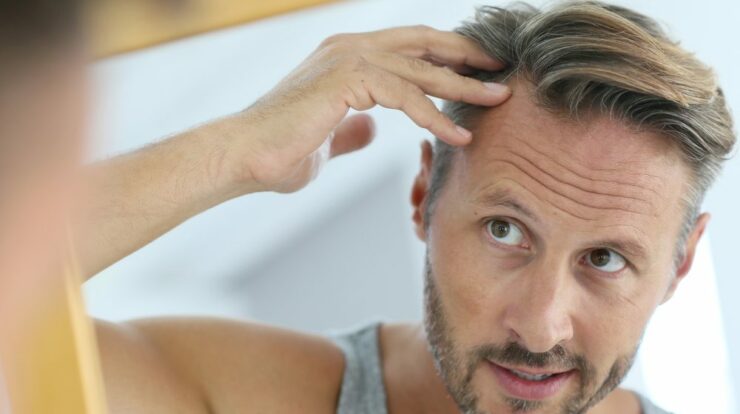 Understanding Male Pattern Baldness and Your Treatment Options