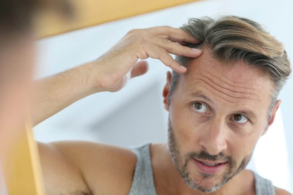 Understanding Male Pattern Baldness and Your Treatment Options